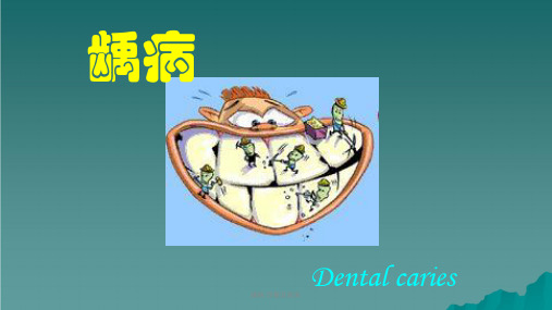 龋病 详解及图库课件