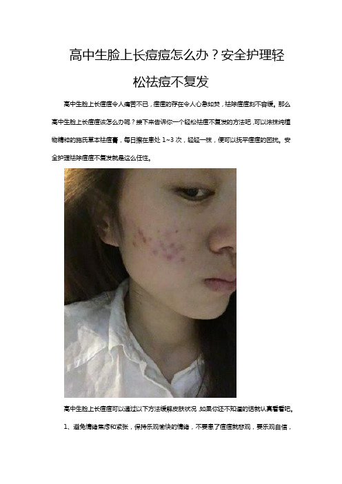高中生脸上长痘痘怎么办？安全护理轻松祛痘不复发