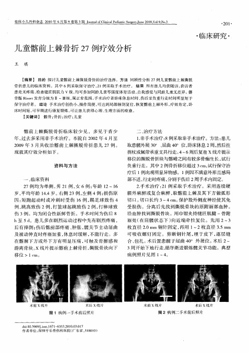 儿童髂前上棘骨折27例疗效分析