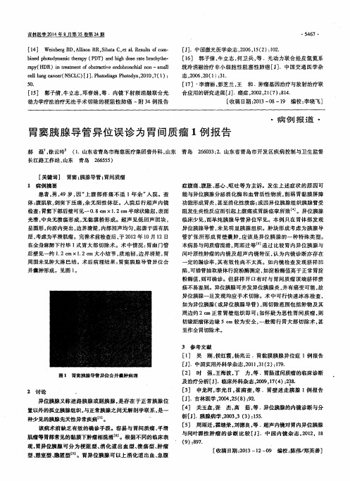 胃窦胰腺导管异位误诊为胃间质瘤1例报告