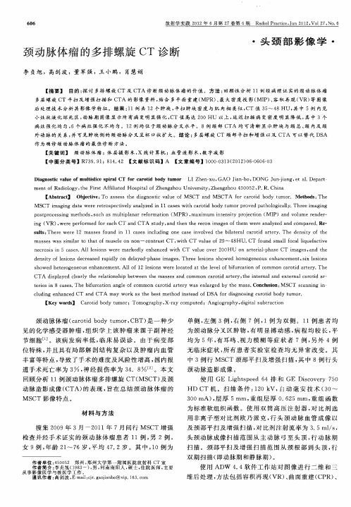 颈动脉体瘤的多排螺旋CT诊断