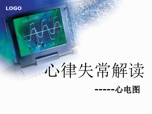 心电图的快速阅读