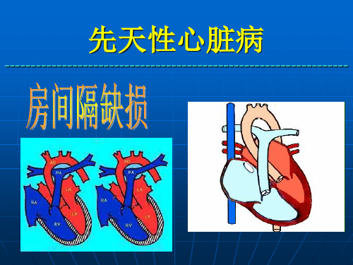 asd先天性心脏病房缺