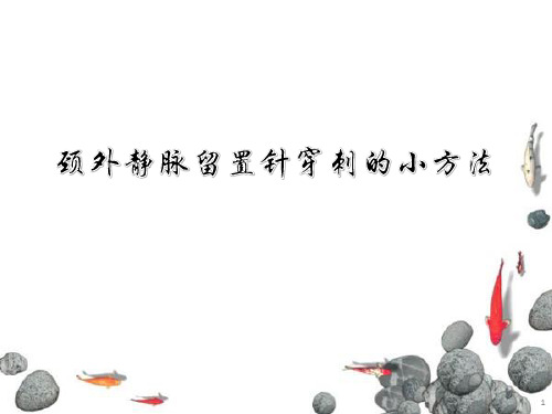 颈外静脉留置针穿刺的小方法PPT课件