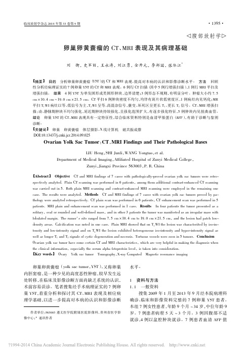 卵巢卵黄囊瘤的CT_MRI表现及其病理基础_刘衡