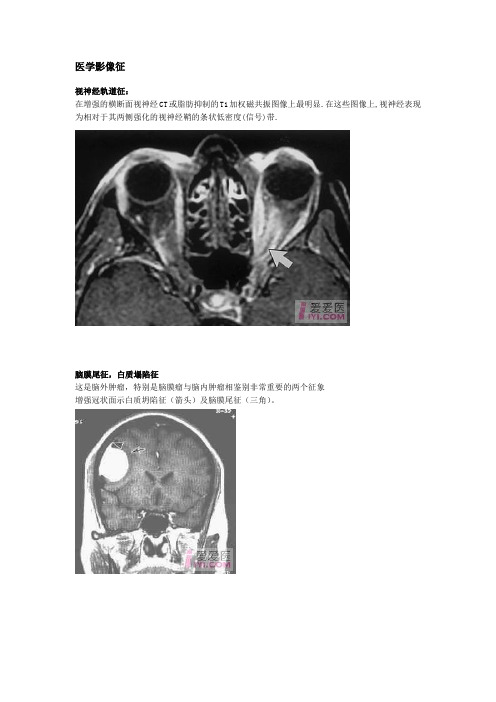 医学影像征 (图)