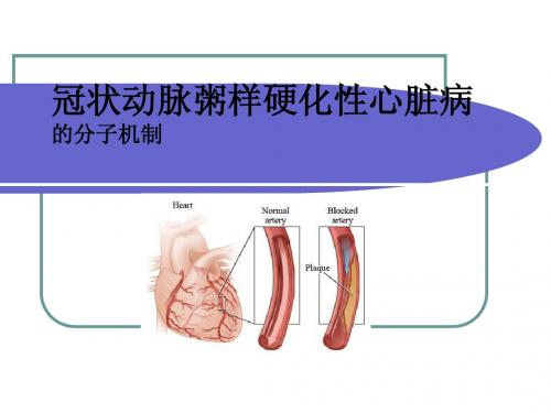 冠状动脉粥样硬化性心脏病