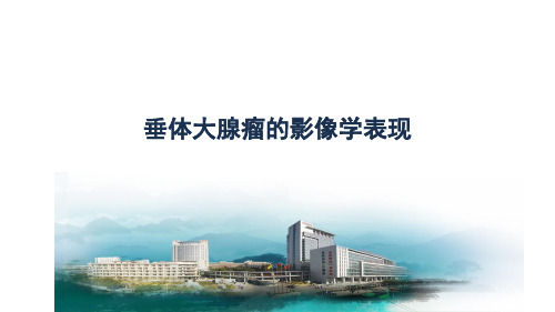 垂体大腺瘤