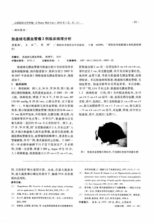胎盘绒毛膜血管瘤2例临床病理分析