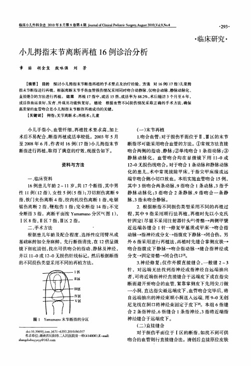 小儿拇指末节离断再植16例诊治分析