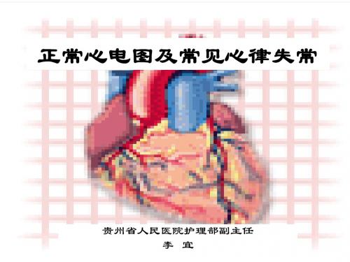 心电图讲义新
