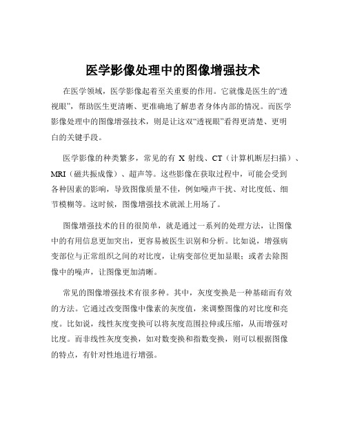 医学影像处理中的图像增强技术