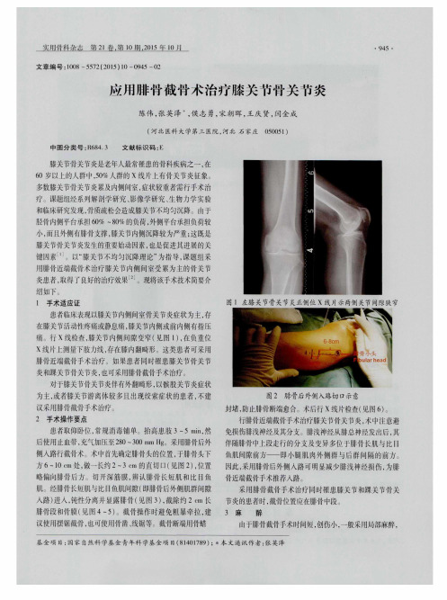应用腓骨截骨术治疗膝关节骨关节炎