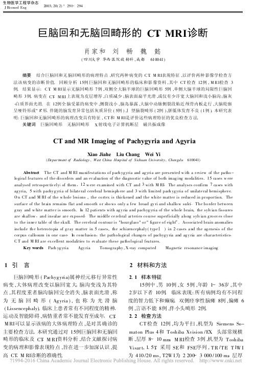 巨脑回和无脑回畸形的CT_MRI诊断