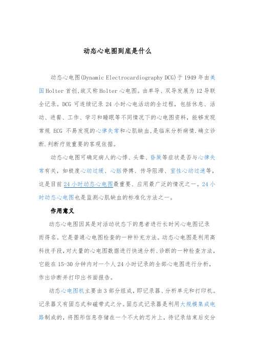 动态心电图