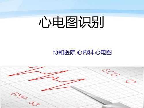 规培结业考前辅导--心电图PPT课件