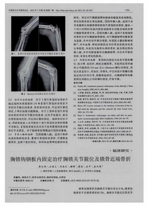 胸锁钩钢板内固定治疗胸锁关节脱位及锁骨近端骨折