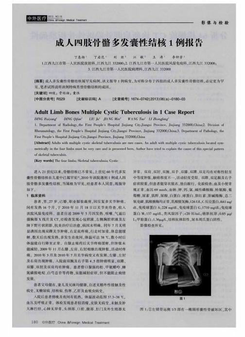 成人四肢骨骼多发囊性结核1例报告