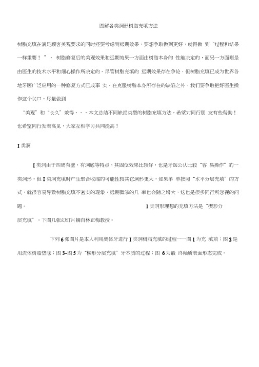 图解各类洞形树脂充填方法