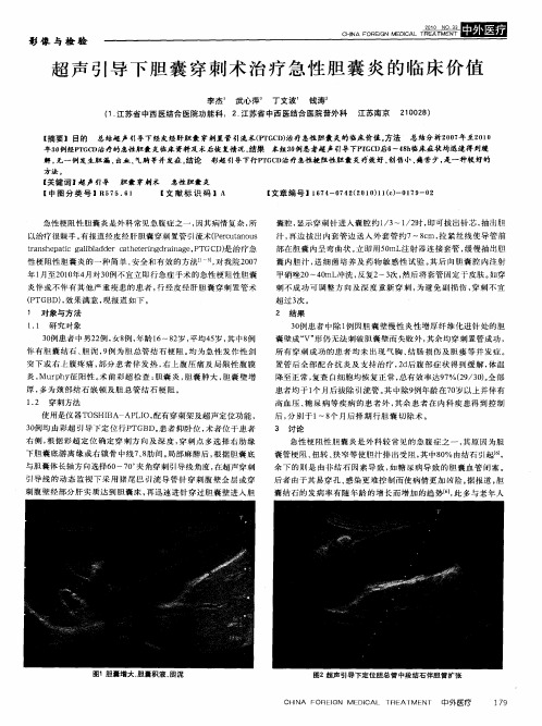 超声引导下胆囊穿刺术治疗急性胆囊炎的临床价值