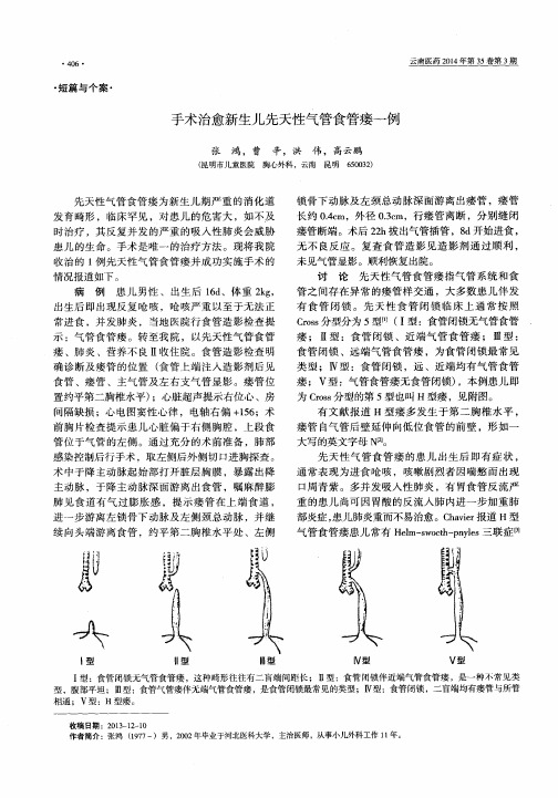 手术治愈新生儿先天性气管食管瘘一例