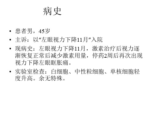 眼眶炎性假瘤的MRI表现