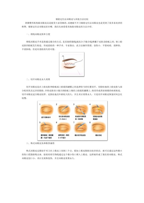 镭射定位法双眼皮与其他方法比较