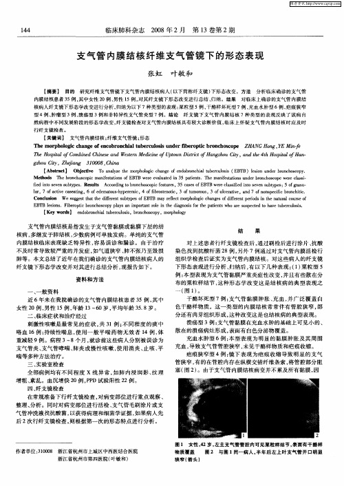 支气管内膜结核纤维支气管镜下的形态表现