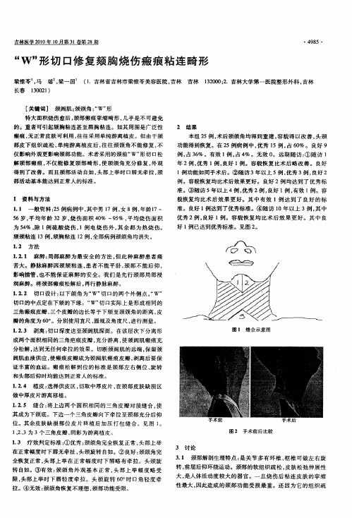 “W”形切口修复颏胸烧伤瘢痕粘连畸形