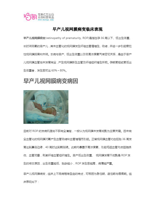 早产儿视网膜病变临床表现