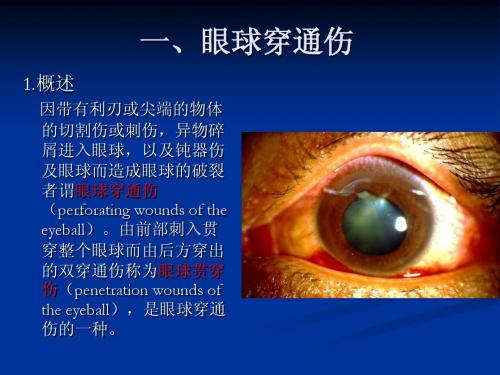 眼外伤住院患者的处理