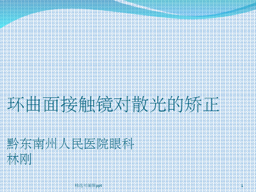 环曲面接触镜对散光的矫正