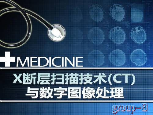 数字图像处理的应用---ct 共59页