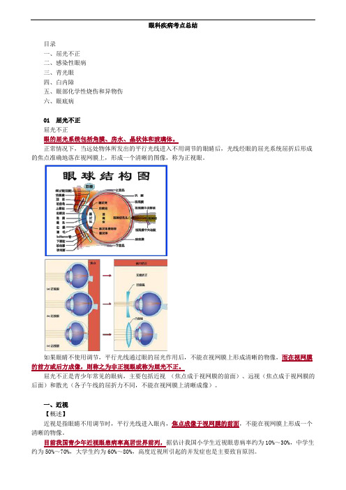 眼科疾病考点总结
