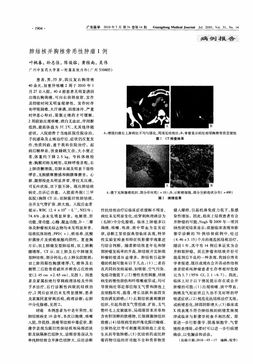 肺结核并胸椎旁恶性肿瘤1例