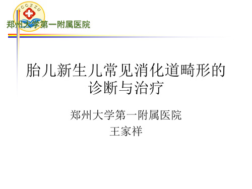 胎儿新生儿常见消化道畸形的诊治