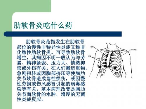 肋软骨炎吃什么药.