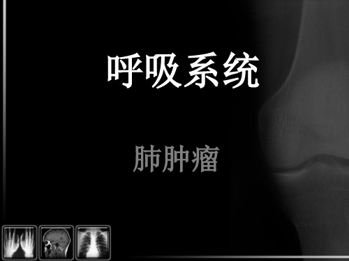 呼吸系统5—肺肿瘤结节病PPT