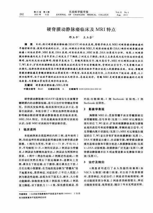 硬脊膜动静脉瘘临床及MRI特点