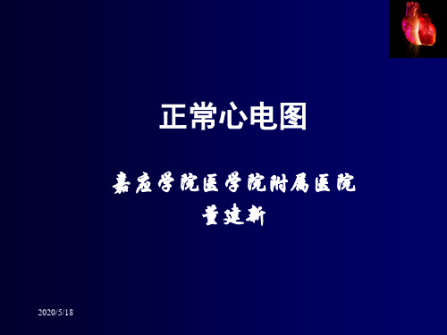 正常心电图
