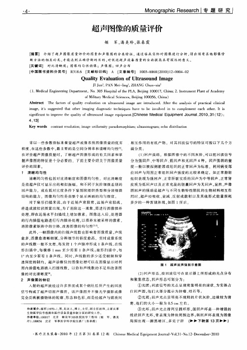 超声图像的质量评价