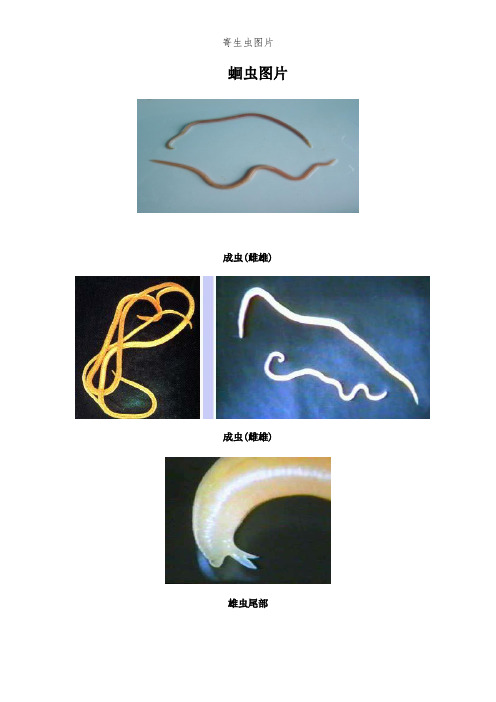 寄生虫图片