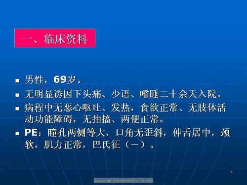 脑淋巴瘤