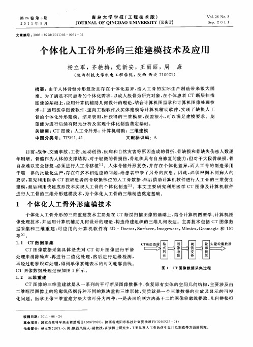 个体化人工骨外形的三维建模技术及应用