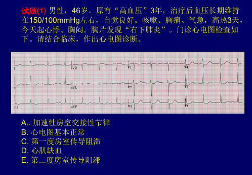 心电图试题