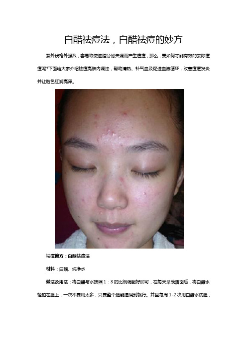 白醋祛痘法,白醋祛痘的妙方