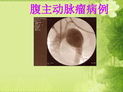 腹主动脉瘤内科治疗成功病案一例