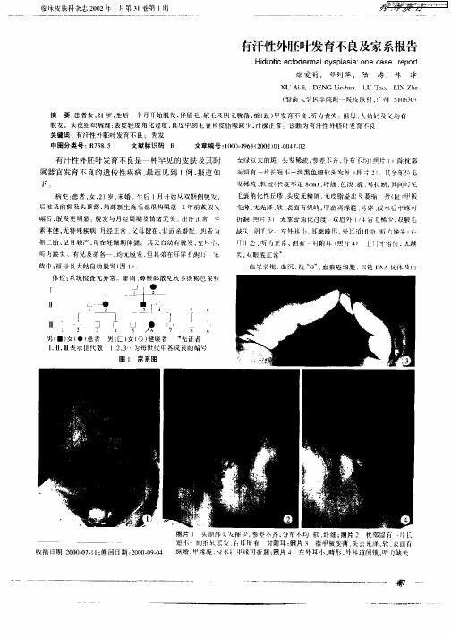 有汗性外胚叶发育不良及家系报告