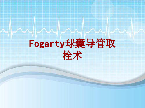 手术讲解模板：Fogarty球囊导管取栓术