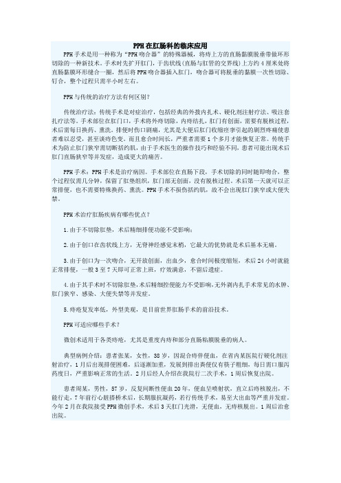 PPH在肛肠科的临床应用